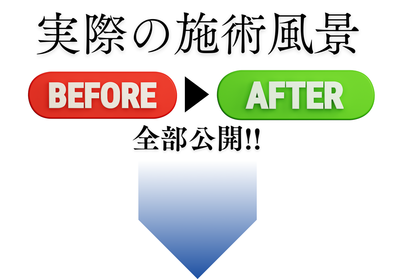 ぎっくり背中|倉敷市ジール鍼灸整骨院
