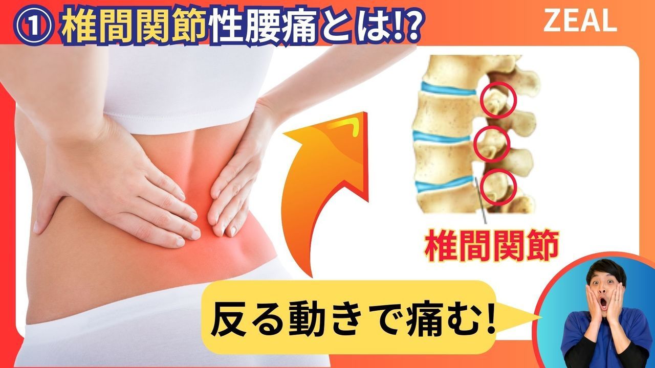 岡山県倉敷市西中新田６２１−４｜ジール鍼灸整骨院倉敷院｜ぎっくり腰 椎間関節性腰痛