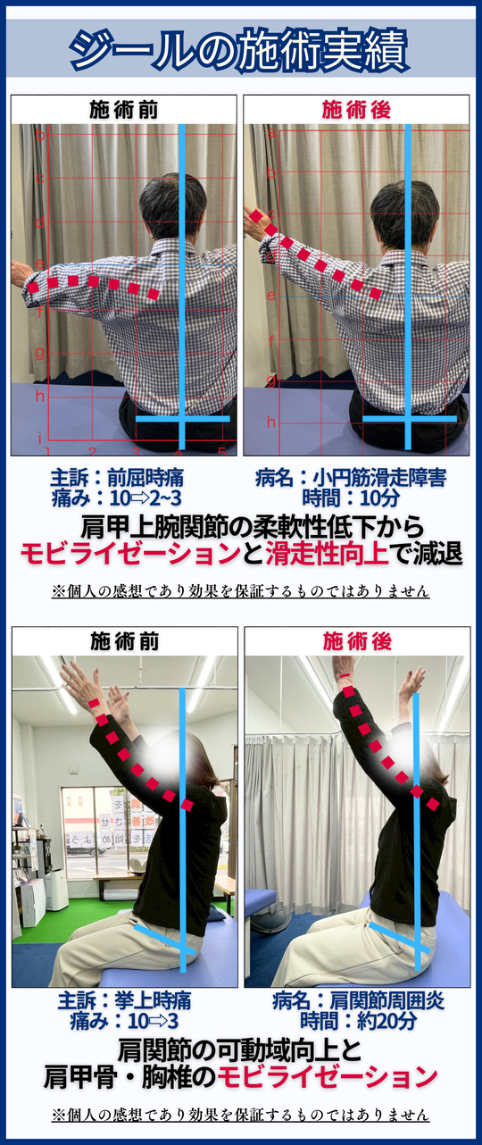 四十肩・五十肩 - 倉敷市ジール鍼灸整骨院 ｜整体院